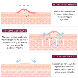 Crema per la rimozione delle smagliature organica anti-smagliature per la cura <span class=keywords><strong>della</strong></span> pelle con etichetta privata di maternità naturale all'ingrosso - Product Image 6