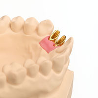Couronne dentaire en zircone de haute qualité pour cliniques et laboratoires |   Durable, fabriqué avec précision pour des performances fiables
