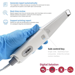 <span class=keywords><strong>Scanner</strong></span> intracorale <span class=keywords><strong>3D</strong></span> dentale di alta qualità <span class=keywords><strong>3D</strong></span> <span class=keywords><strong>Scanner</strong></span> Intra orale per veterinario - Product Image 5