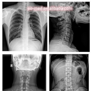 เครื่องเอกซเรย์เคลื่อนที่แบบพกพา 50 กิโลวัตต์ ภาพความละเอียดสูง ระบบถ่ายภาพรังสีดิจิทัลความถี่สูง พร้อมจอภาพ FPD รุ่น XM520B ขั้นสูง - Product Image 6