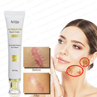 Crème Réparatrice Naturelle Visage et Corps Contre les Cicatrices – Efficacité Rapide pour Lisser et Éliminer les Marques de Grossesse, Vergetures, Boutons et Cicatrices d'Acné
