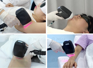 2024 mới nhất <span class=keywords><strong>Diode</strong></span> <span class=keywords><strong>Laser</strong></span> 755 808 1064 <span class=keywords><strong>Laser</strong></span> vẻ đẹp thiết bị Lazer <span class=keywords><strong>Diode</strong></span> Máy tẩy lông bằng <span class=keywords><strong>laser</strong></span> <span class=keywords><strong>Diode</strong></span> cho tất cả các da - Product Image 6