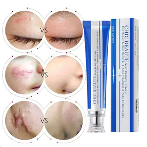 Gel Reparador de Piel Herbal, Rápido y Efectivo, Loción para Eliminar Estrías y Cicatrices, Crema Natural para Marcas de Acné y Granos - Product Image 2