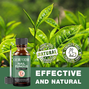 Traitement pour les ongles, accessoire de pédicure pour les pieds et les orteils, traitement pour les doigts et les orteils, Nail-art, 120 pièces - Product Image 5