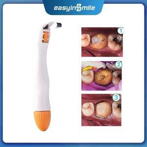 Easyinsmile nha khoa ma trận prosecto ma trận ban nhạc Matrice nha khoa phần kim loại ma trận hệ thống 50 cái mỗi hộp cong ban nhạc 4.5mm - Product Image 3