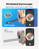 Otoscope Wifi étanche Bebird R1 avec caméra numérique pour le nettoyage des oreilles et l'élimination du cérumen