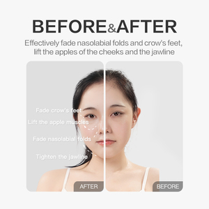 <span class=keywords><strong>Appareil</strong></span> de beauté OEM/ODM flexible et ajustable pour la peau, <span class=keywords><strong>anti</strong></span>-âge, raffermissant et liftant, avec 30 recharges originales, pour usage domestique - Product Image 6