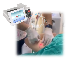 Pldd Evlt Aderbehandeling Minimaal Plastische Chirurgie 980nm 1470nm Diode Optica Fiber Laser Disc Hernia/Spinale Schijf Chirurgie - Product Image 1