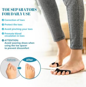 Corrector de Juanetes con Soporte de Arco Aislado de Silicona Negra y Diseño de Cinco Orificios, Separador de Dedos para Hombres/Mujeres, Restaura la Forma Original del Dedo - Product Image 3