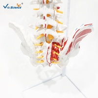 Modelo Anatómico de Columna Vertebral y Pelvis con Músculos de Colores, para Entrenamiento de Fisioterapia, con Certificaciones CE/ISO/ROHS/CNAS