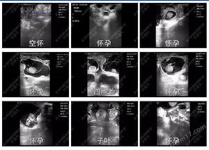 Alat Sonografi Genggam XUCHN RKU10 untuk Hewan Ternak, Terlaris dan Hemat Biaya, Alat Diagnostik Hewan Kelas Klinik, Bersertifikasi CE - Product Image 4