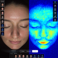 Dermatoscope Analyseur de Peau Miroir Intelligent avec Analyse de l'Hydratation du Visage Compatible Prises US & ZA