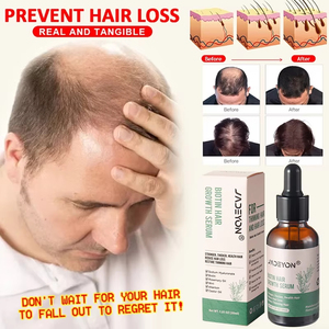 Personnalisé 100% Naturel Organique Marque Privée Essentiel Rapide Cheveux Sauvage Croissance Sérum Romarin Menthe Huile pour Femmes Noires Hommes - Product Image 1
