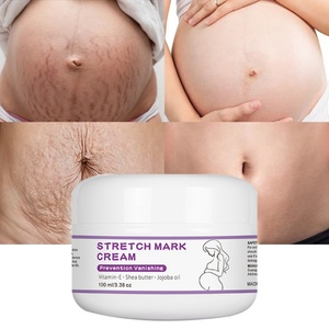 Autocollants personnalisés, crème anti-vergetures, soins de grossesse, produits pour femmes enceintes, produits de santé - Product Image 1