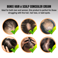 Crème de camouflage épaississante, spray brun foncé pour la ligne des cheveux et correcteur de cuir chevelu pour cheveux clairsemés, cache-taches chauves pour hommes avec système
