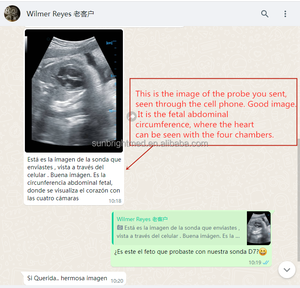 SUN-D7 Peut Utiliser à la Fois le WIFI et le USB Sonde d'Échographie Vétérinaire Sans Fil à Double Tête Mini Machine d'Échographie Sans Fil - Product Image 6