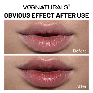 Bálsamo Labial de Menta de Marca Privada, Tratamiento Humectante e Iluminador de Labios con Vitamina E y Colágeno para Labios Secos y Agrietados - Product Image 5