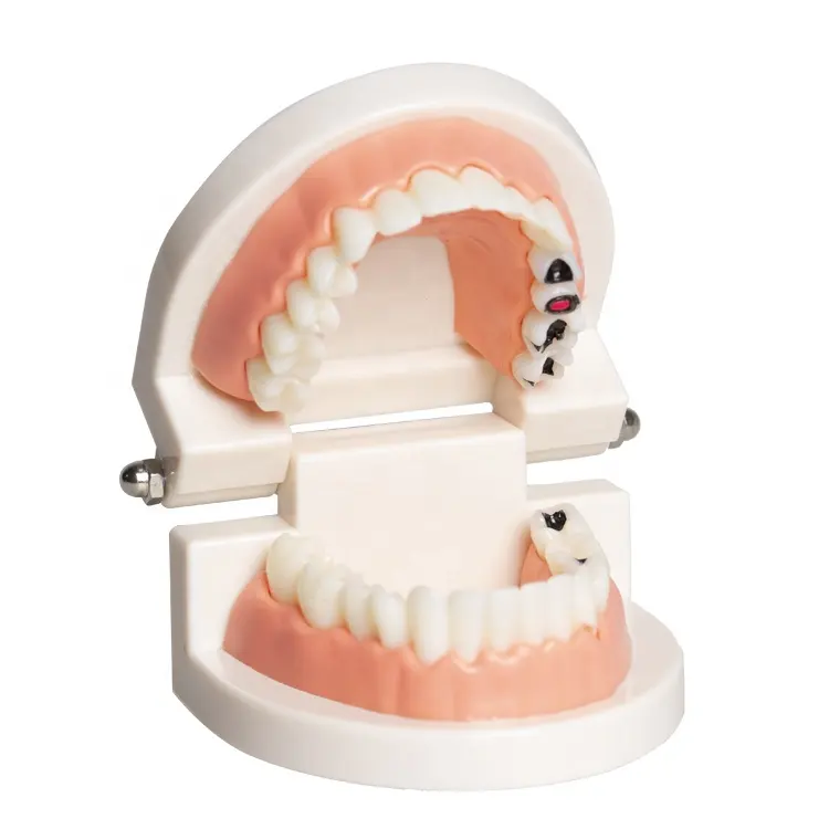 โรงงานขายส่งพลาสติกมาตรฐานทันตกรรมฟันผุรุ่นสำหรับเด็กการดูแลช่องปากการเรียนการสอน