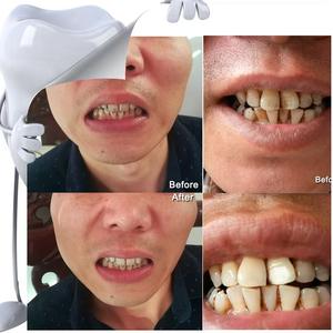 Nouveau <span class=keywords><strong>kit</strong></span> innovant de mini gomme à dents blanchissante pour les dents à usage quotidien à la maison Meilleures ventes en Europe Kits de nettoyage des dents gomme à dents - Product Image 6