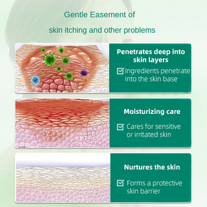 2 In 1 Huid Anti Jeuk Crème En Spray Psoriasis Dermatitis Huiduitslag <span class=keywords><strong>Vagina</strong></span> Verwijderen Vrouwen/Man Jeuk Zalf - Product Image 6