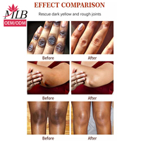 MLB – crème pour le visage organique éclaircissante, Anti-taches de rousseur, acide hyaluronique, dissolvant de taches foncées, correcteur