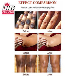 MLB-crema facial con ácido hialurónico, crema facial correctora de brillo orgánico de Etiqueta Privada, antipecas, eliminador de manchas oscuras - Product Image 6