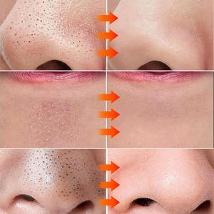 Сыворотка для ухода за кожей от прыщей - Product Image 3