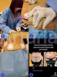 الألياف البصرية Arfurla 3 أمتار 980 نانومتر فيبرا أوبتيكا ليزر 1470 نانومتر ملحقات الألياف البصرية العارية 400um 600um SMA905 - Product Image 6