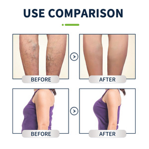 Bain de pieds à l'armoise de Jiang - Bain de pieds détoxifiant aux herbes pour la relaxation et l'amincissement - Product Image 6