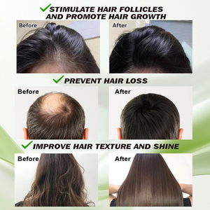 <span class=keywords><strong>Tonique</strong></span> Capillaire Naturel pour la Croissance des Cheveux 100ml Sans Rinçage Extraits d'Herbes Chinoises de Haute Qualité Menthe Poivrée Menthol Bio Répare les Pointes Fourchues - Product Image 4