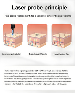 Traitement professionnel au picoseconde des tatouages de différentes couleurs, élimination de l'acné et des cicatrices, haute puissance, plus rapide et sûr - Product Image 4