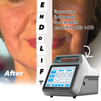 Endolifting 980nm et 1470nm, liposuccion par fibres, liposuccion Vaser, endolift chirurgical cutané