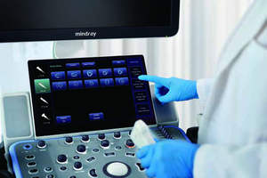 Ecógrafo Veterinario Mindray Vetus 5 con Doppler Color, Imágenes HD, Certificado CE, 1 Año de Garantía - Product Image 6