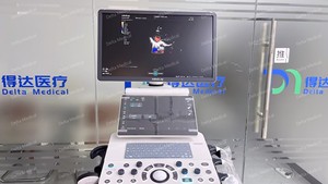 Échographe portable Mindray Consona N5S avec fonctions TDI et CW, échographe 3D 4D 5D Mindray adapté aux services publics - Product Image 6