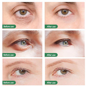 개인 라벨 블랙 대나무 숯 클렌징 수화 하이드로겔 아이 패치 크리스탈 보습 콜라겐 젤 아이 마스크 - Product Image 4