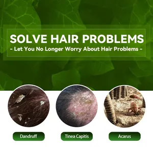 EELHOE 100% Natural Moisturizing Anti Itching Remove Tinea Capitis Mites Plant Extract Herbal Anti-Dandruff Shampoo