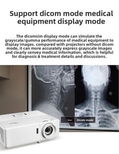 Projecteur laser DLP Optoma LSF8171 à longue portée pour extérieur, compatible 3D, 1080P, prise en charge 4K, portable, 5000 lumens, pour usage domestique et professionnel, garantie 3 ans - Product Image 5