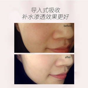 מכשיר פנים מקצועי לסלון יופי - 12 ב-1 הידרו דרמבריישן עם תרסיס ננו ופונקציית חמצן לפנים - Product Image 4