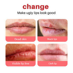 Bálsamo Labial Humectante con Sabor a Frutas 5g para Uso Diario, Barra Hidratante para el Cuidado de los Labios, Personalización de Marca Privada Disponible - Product Image 3