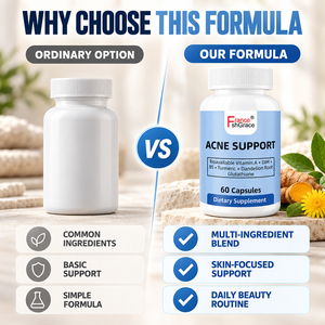 Cápsulas Shecome para el Apoyo del Acné con Ingredientes Personalizados, para la Salud del Cabello, Uñas y Piel, Suplemento Dietético para el Apoyo del Acné en Adultos - Product Image 6