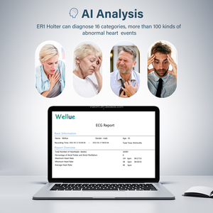 Viatom <span class=keywords><strong>24</strong></span> giờ holter màn hình mặc di động <span class=keywords><strong>ECG</strong></span> giá của <span class=keywords><strong>ECG</strong></span> Máy ekg màn hình thông minh <span class=keywords><strong>ECG</strong></span> holter màn hình - Product Image 3