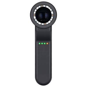 Iboolo libero su misura DE4100 Pro Dermoscope con la luce UV per la lampada del legno di infezione batterica - Product Image 6