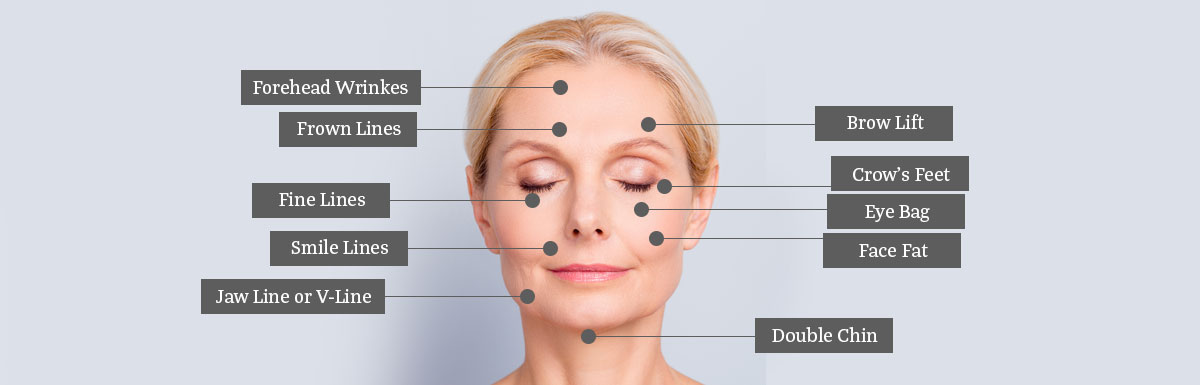 Multifunctional facial beauty Vmax Face Lifting RF HIFU Home Use Mini Skin Tightening Wrinkle Remover Machine