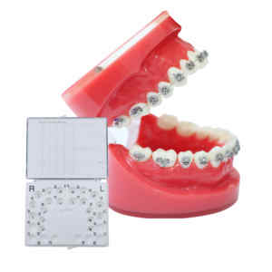 Ensemble de supports orthodontiques en céramique en métal Shinye support miniature de dent dentaire supports orthodontiques orthodontiste accolades dentaires - Product Image 1