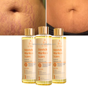 El mejor aceite esencial a base de hierbas naturales para eliminar estrías, reparación reafirmante de la piel, mejora la elasticidad de la piel, aceite de eliminación de cicatrices OEM - Product Image 2