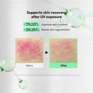 Sérum exfoliant de nuit pour le visage Reedle Shot 700 30ml à l'acide hyaluronique et au Cica pour femmes - Product Image 4