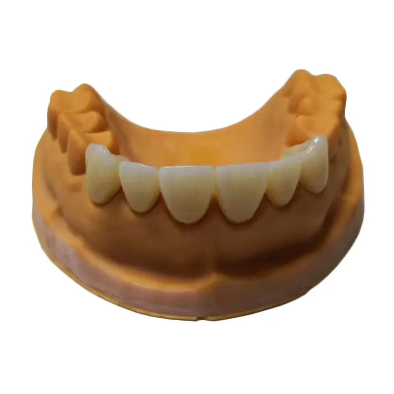 Dentaire personnalisé 3D impression SLA résine dents modèle médical