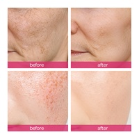 Crème Visage Correctrice de Taches Sombres Légère avec Logo Personnalisé, Soin de la Peau, 7% Alpha Arbutine + 4% TXA