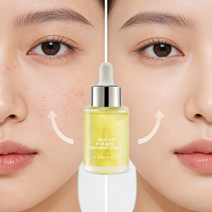 Suero Antiacné al por Mayor, Suministro de Fábrica, Suave y Calmante, Elimina el Acné en Profundidad - Product Image 1