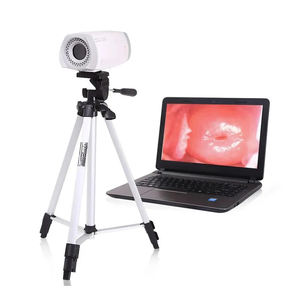 กล้องวิดีโอดิจิทัลสำหรับตรวจภายในช่องคลอดสำหรับนรีเวชวิทยา ดีไซน์ใหม่ กล้องส่องตรวจทาง<span class=keywords><strong>การ</strong></span>แพทย์แบบพกพา - Product Image 4